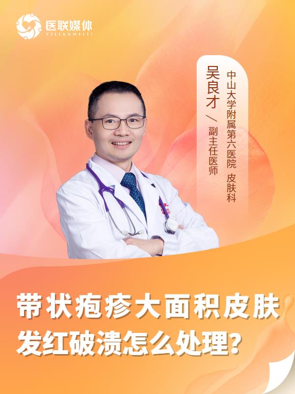 带状疱疹大面积皮肤发红破溃怎么处理？