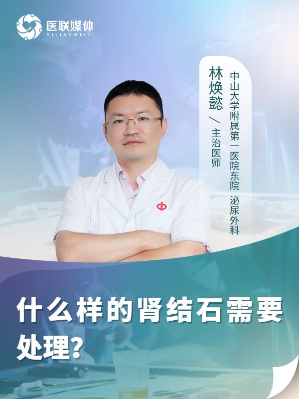什么樣的腎結石需要處理？