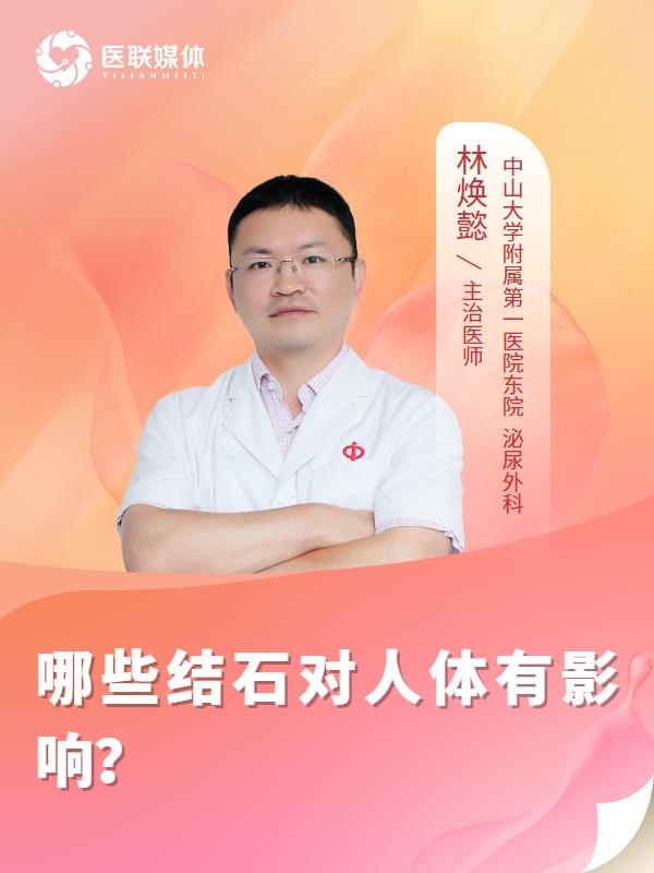 哪些結(jié)石對(duì)人體有影響？