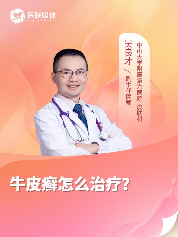 牛皮癣怎么治疗？